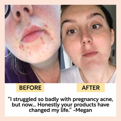 Face Moisturizer with Vitamin E, Aloe Vera